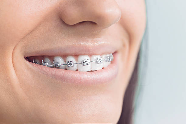 Best Dental Fillings (Composite and Amalgam)  in Orangeville, UT